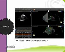 包含顶尖球员百尺竿头更进一步，向卓越冠军冲刺的词条